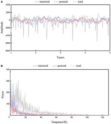 Epileptic Seizure Detection Based on EEG Signals and CNN